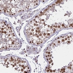 C14orf39 Antibody, Novus Biologicals:Antibodies:Primary Antibodies